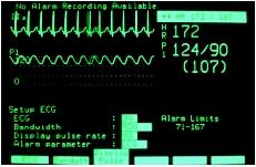 Cardiac monitors display such vital signs as heart rate, pulse, and blood pressure for patients in the intensive care unit. (Photograph by Hank Morgan. Science Source/Photo Researchers. Reproduced by permission.)
