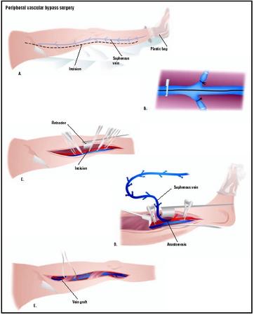 Veins Anatomy: Carotid, Iliac Arteries,.